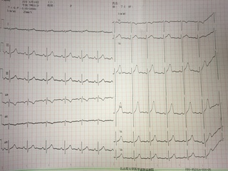 心電図