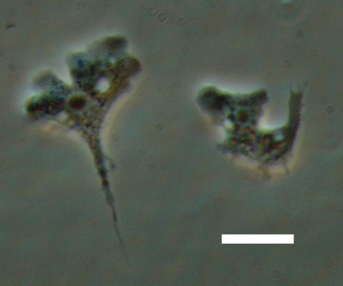 水田土壌から分離した新種のアメーバ .jpg