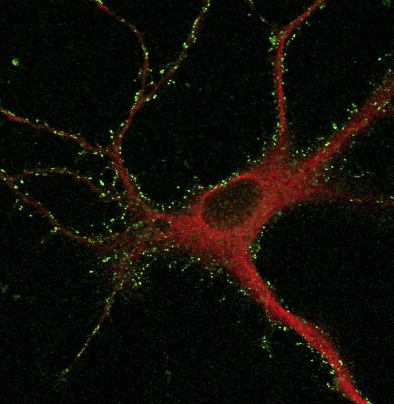 20210401_Image_labeled neuron.jpg