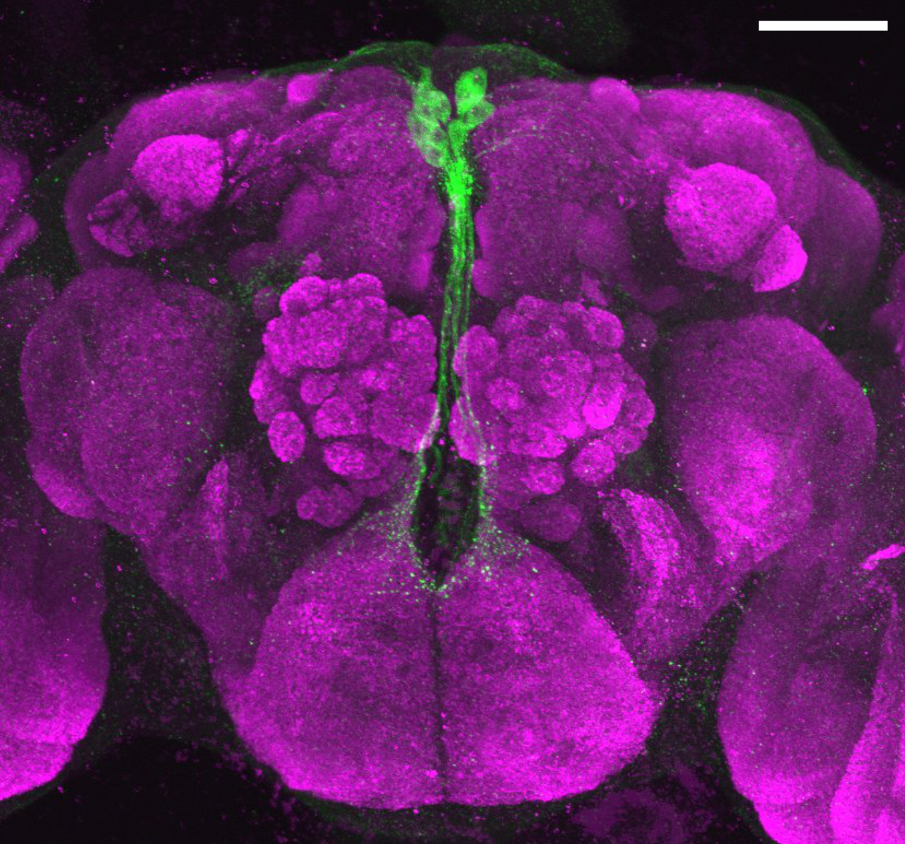 insulin producing cells.png