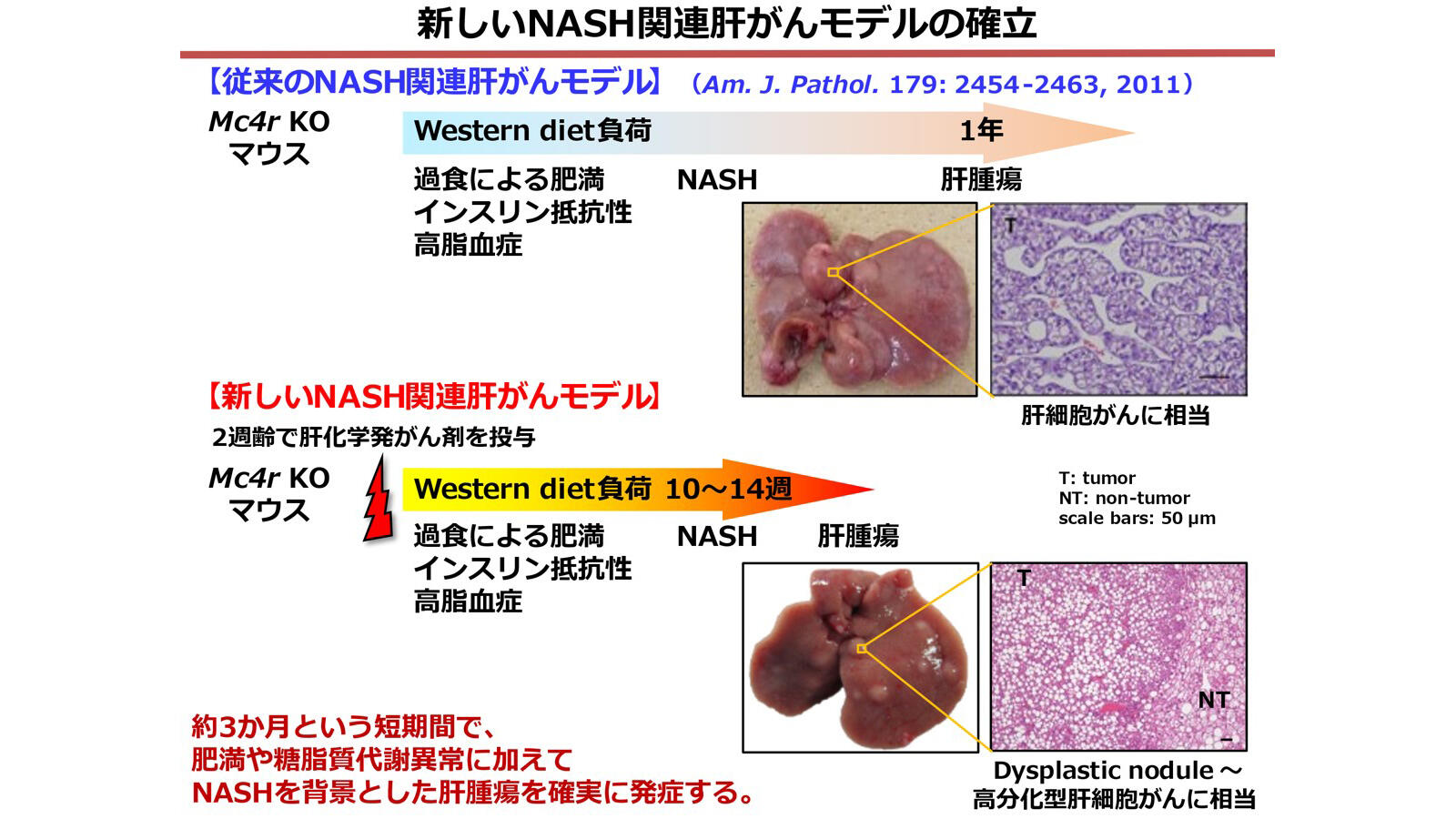 原因と危険因子