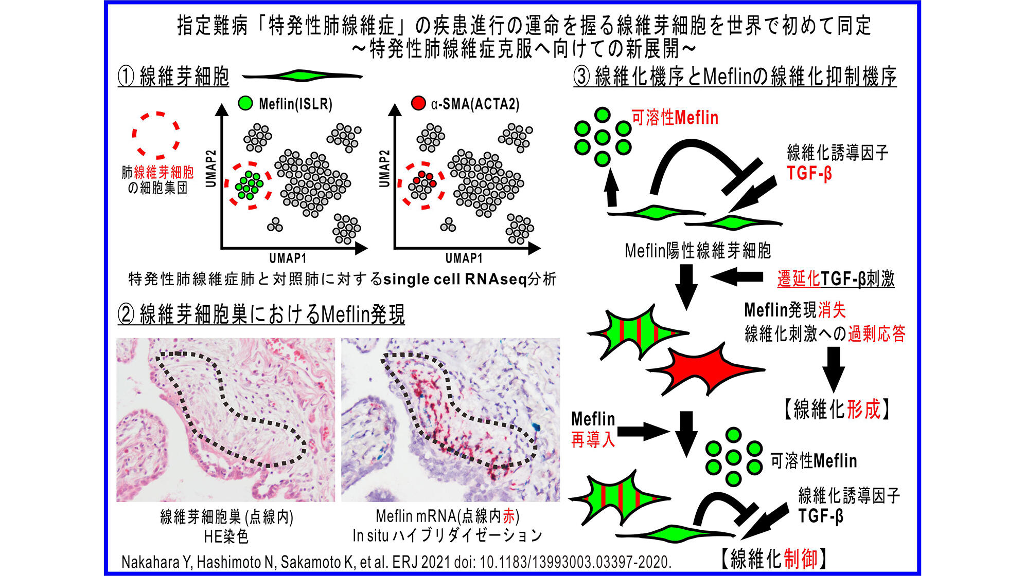 CPFE特有の症状