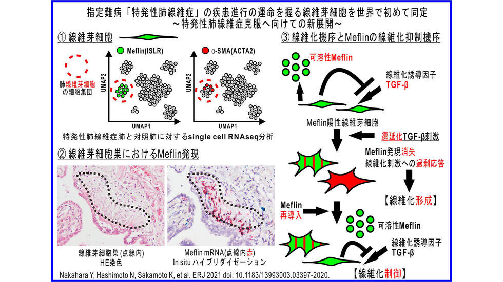 重要なポイント