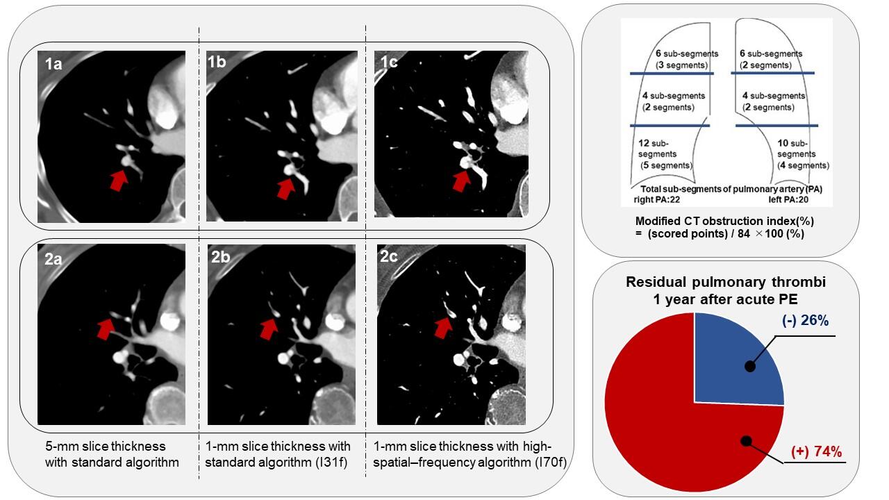 長期的な見通しは何ですか?