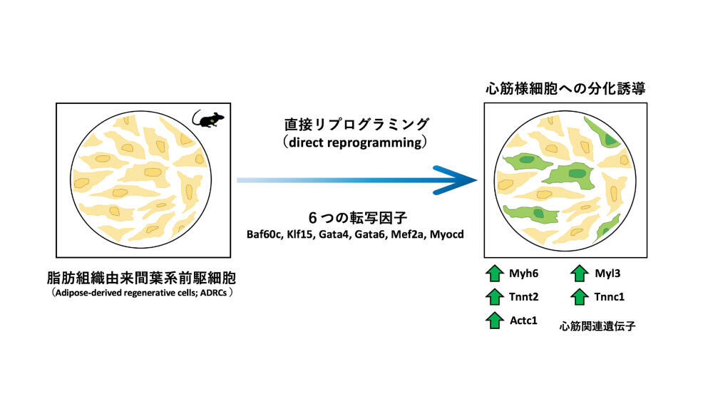 ６つの転写因子を用いた成体脂肪組織由来間葉系前駆細胞（ADRC）の心筋