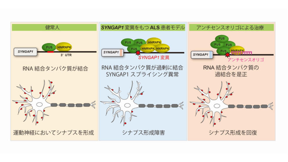 EMGにはリスクはありますか?