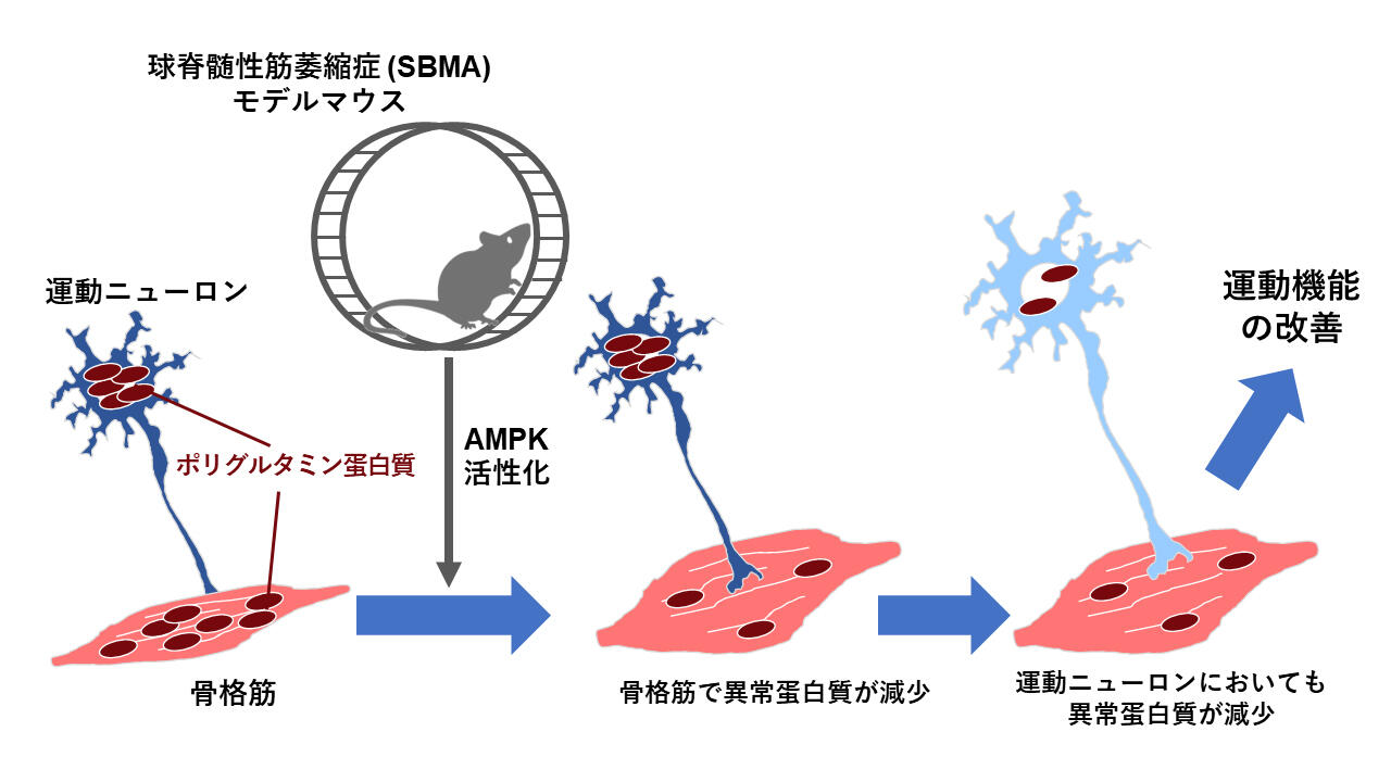 神経筋骨格障害の臨床評価 神経難病に対する運動療法の作用メカニズムを解明 〜ポリ