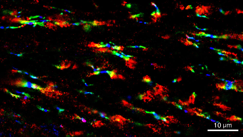 知的発達症関連タンパク質 LGI3 が脳内の神経伝達を制御する仕組みを