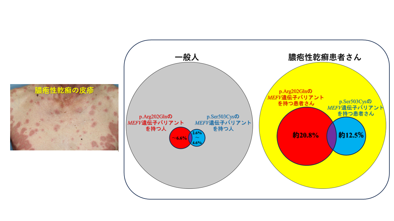 口の中の乾癬