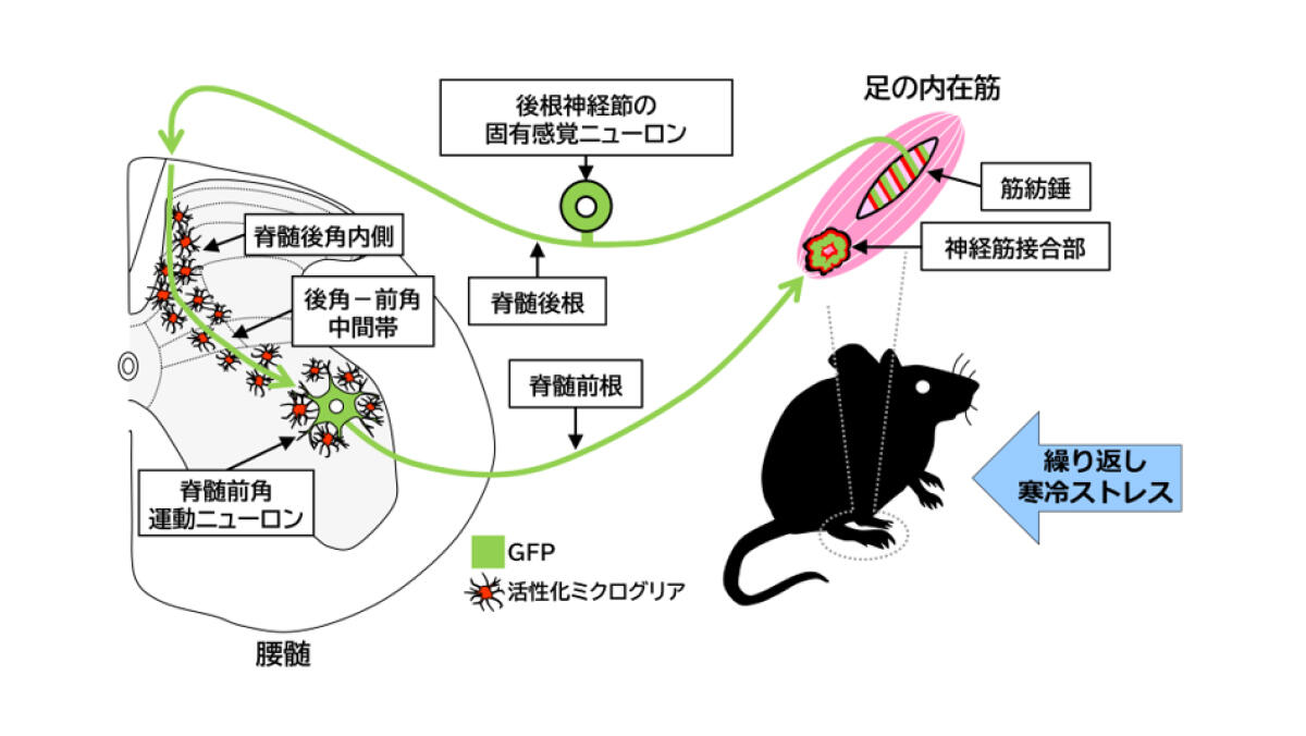 線維筋痛症における慢性疼痛発症メカニズムの解明 ～固有感覚