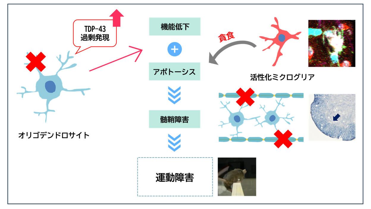 筋萎縮性側索硬化症(ALS)におけるオリゴデンドロサイトの異常がマウス