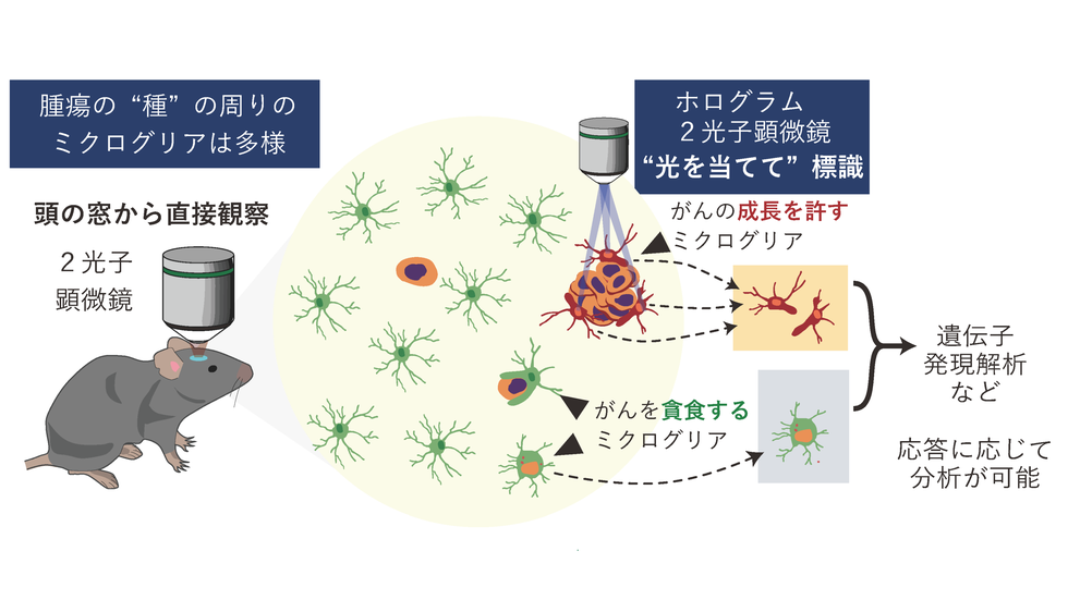 脳転移の最初の瞬間に光を当てる～脳の番人ミクログリアが、がんの「種」を食べる～