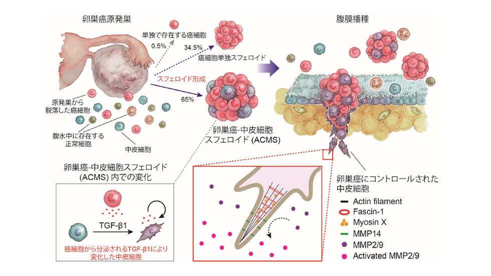 卵巣がんの急速な腹膜播種形成のメカニズムを発見～がん細胞は腹腔内環境を巧みに制御して播種を形成する～
