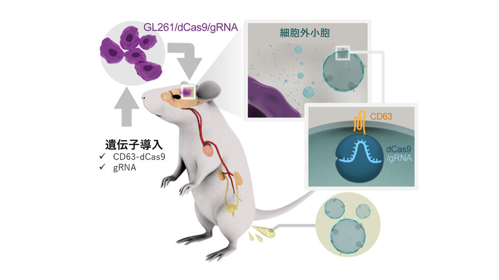 がん由来の微粒子が尿中に出ることを発見-尿を使ったがん細胞の早期検知へ-